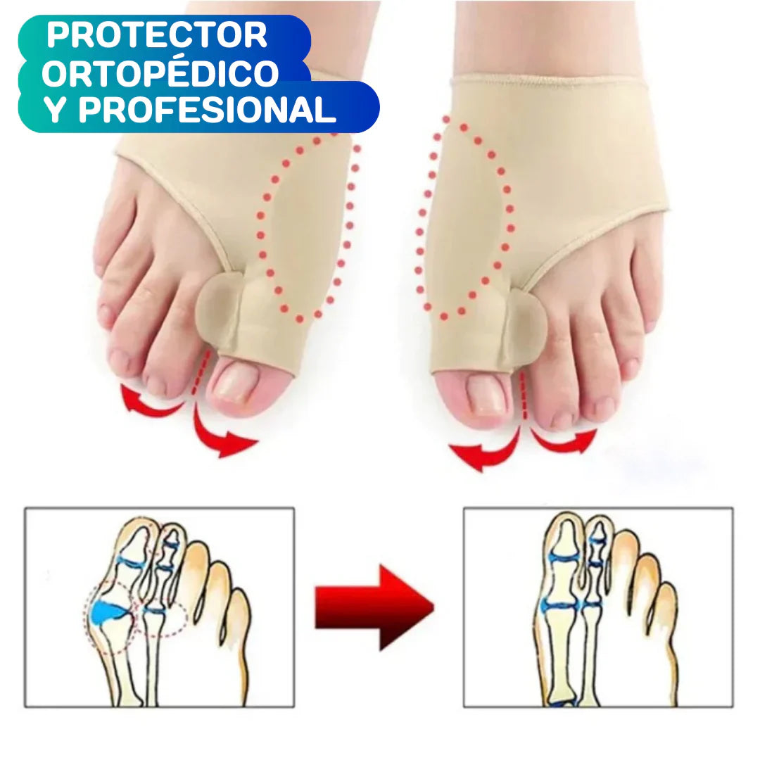 Corrector De Juanetes | Elimina Dolor En Pies
